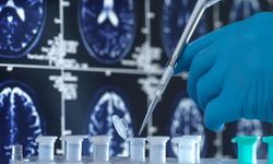 Alzheimer’ın şifresi virüslerde mi saklı?