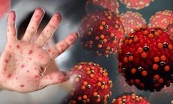 Kızamık vakaları pandemi öncesi seviyeleri aştı