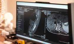 Sinsi ilerleyen bu rahatsızlığı ilk fark eden anneler oluyor