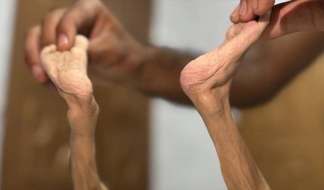 Gazze’de 40 binden fazla bebek ölüm tehlikesiyle karşı karşıya