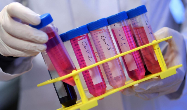 Uzun Kovid’in etkileri parkinson ile benzerlik gösteriyor