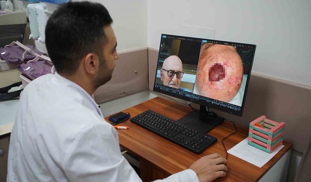 Dünyada 3'üncü kez rastlandı: Saçlı derideki nadir tümör Sakarya'da tedavi edildi