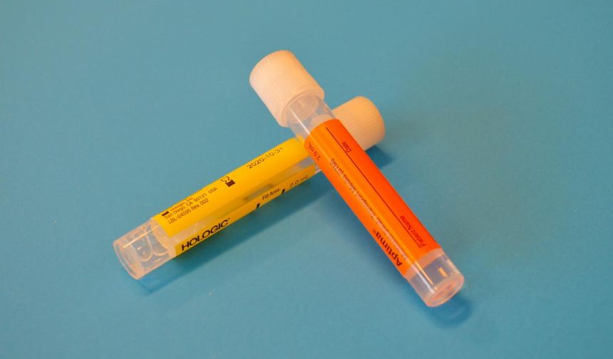 Prostat kanseri teşhisinde çığır açabilecek bir idrar testi geliştirildi